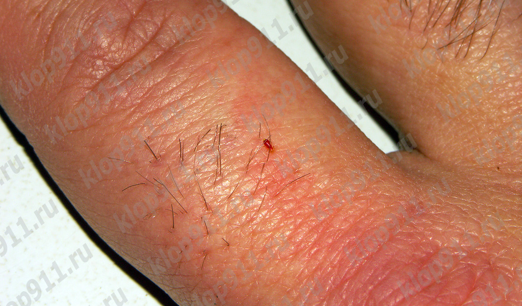 Larva pije krev